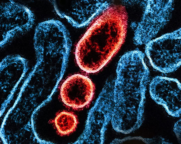 北京红立方机场急救箱,交通急救箱,急救止血绷带,急救包扎包,旋压式止血带等新闻资讯
